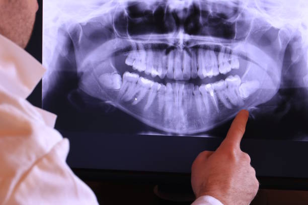 Best Emergency Denture Repair in Mason City, IL